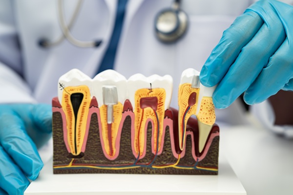 When Root Canal Surgery May Be Recommended To Save Your Tooth